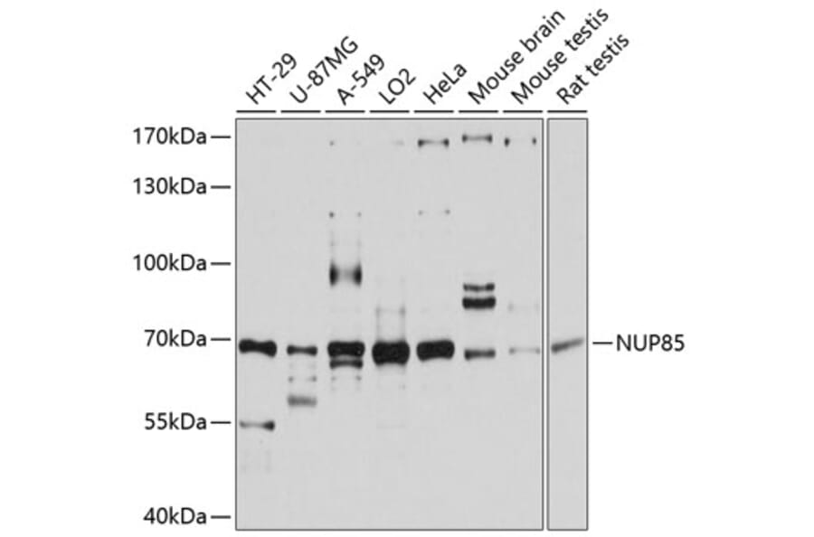 Western Blot - Anti-Pericentrin 1/FROUNT Antibody (A80846) - Antibodies.com