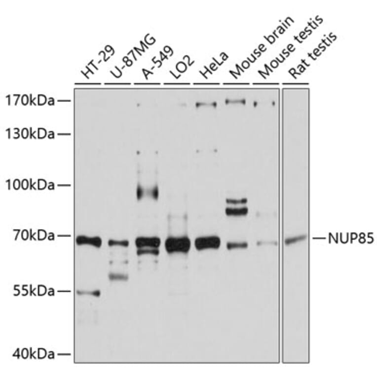 Western Blot - Anti-Pericentrin 1/FROUNT Antibody (A80846) - Antibodies.com