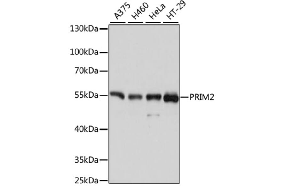 Western Blot - Anti-PRIM2 Antibody (A80847) - Antibodies.com