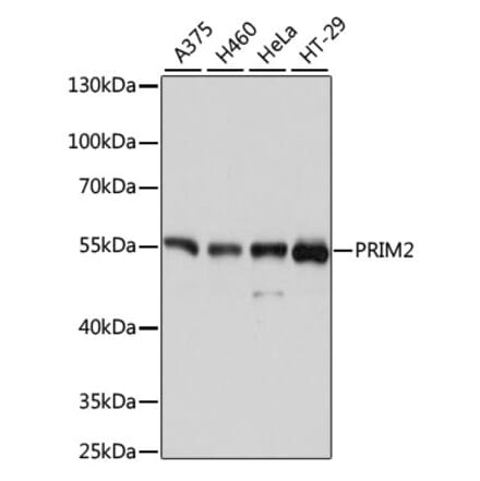 Western Blot - Anti-PRIM2 Antibody (A80847) - Antibodies.com