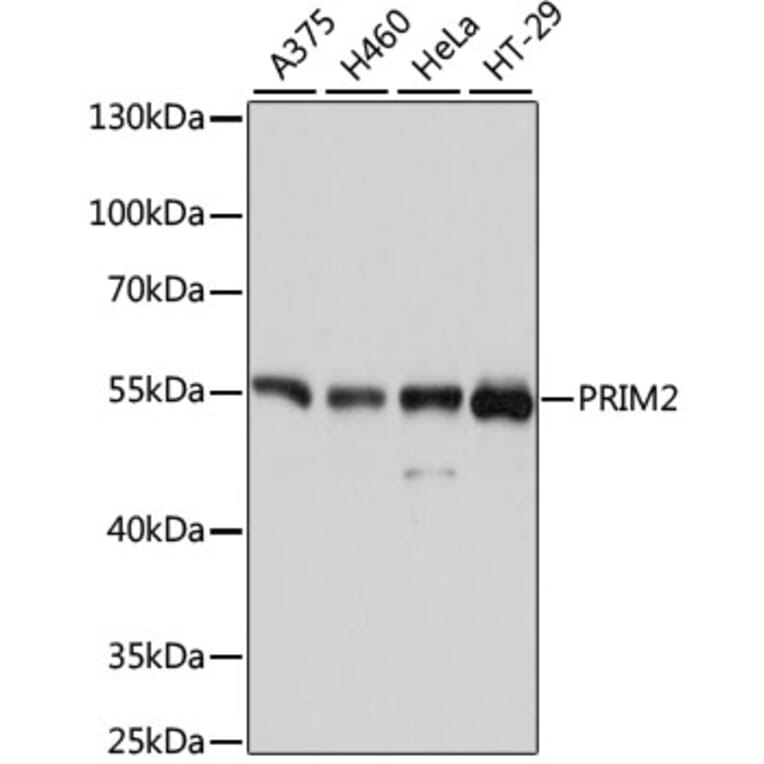 Western Blot - Anti-PRIM2 Antibody (A80847) - Antibodies.com