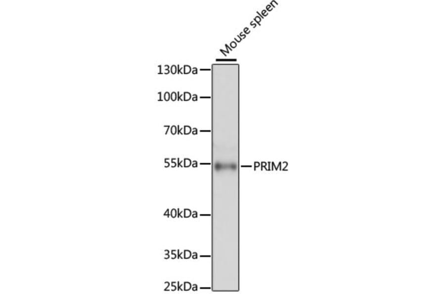 Western Blot - Anti-PRIM2 Antibody (A80847) - Antibodies.com