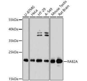 Western Blot - Anti-Rab2 Antibody (A80848) - Antibodies.com