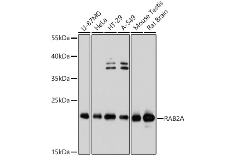 Western Blot - Anti-Rab2 Antibody (A80848) - Antibodies.com