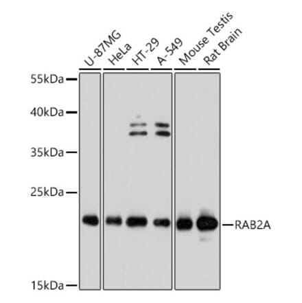 Western Blot - Anti-Rab2 Antibody (A80848) - Antibodies.com