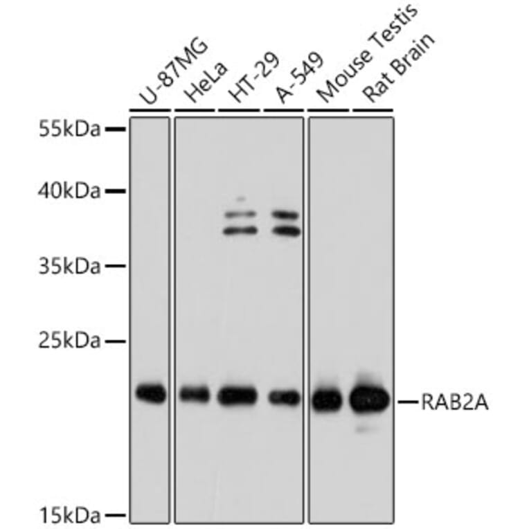 Western Blot - Anti-Rab2 Antibody (A80848) - Antibodies.com