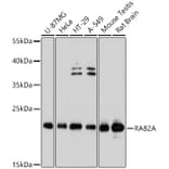 Western Blot - Anti-Rab2 Antibody (A80848) - Antibodies.com