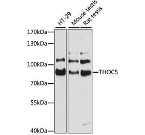 Western Blot - Anti-THOC5 Antibody (A80849) - Antibodies.com