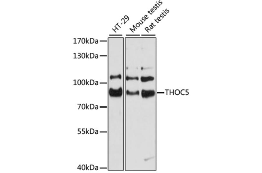 Western Blot - Anti-THOC5 Antibody (A80849) - Antibodies.com