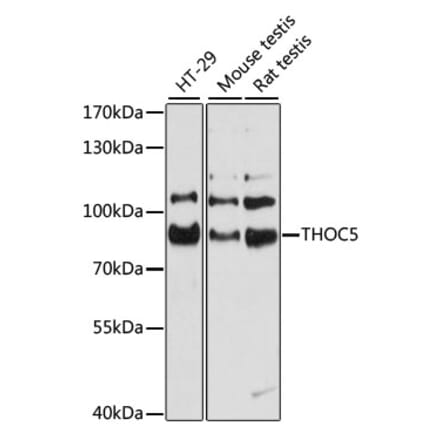 Western Blot - Anti-THOC5 Antibody (A80849) - Antibodies.com