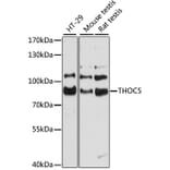 Western Blot - Anti-THOC5 Antibody (A80849) - Antibodies.com