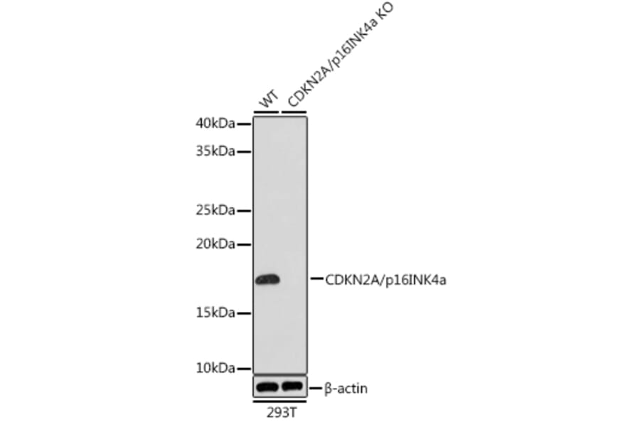 Western Blot - Anti-CDKN2A/p16INK4aF Antibody (A80851) - Antibodies.com