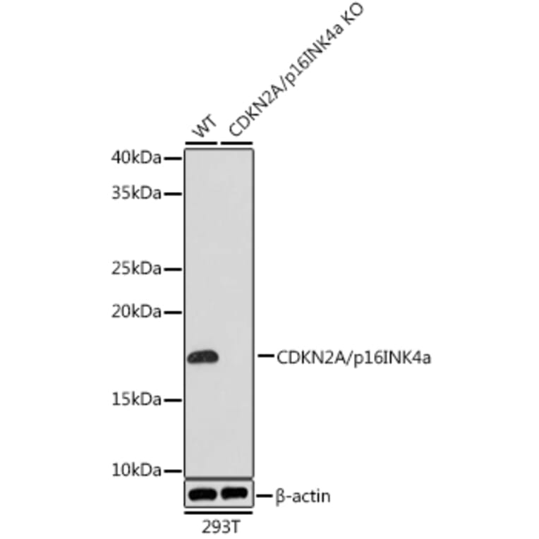 Western Blot - Anti-CDKN2A/p16INK4aF Antibody (A80851) - Antibodies.com