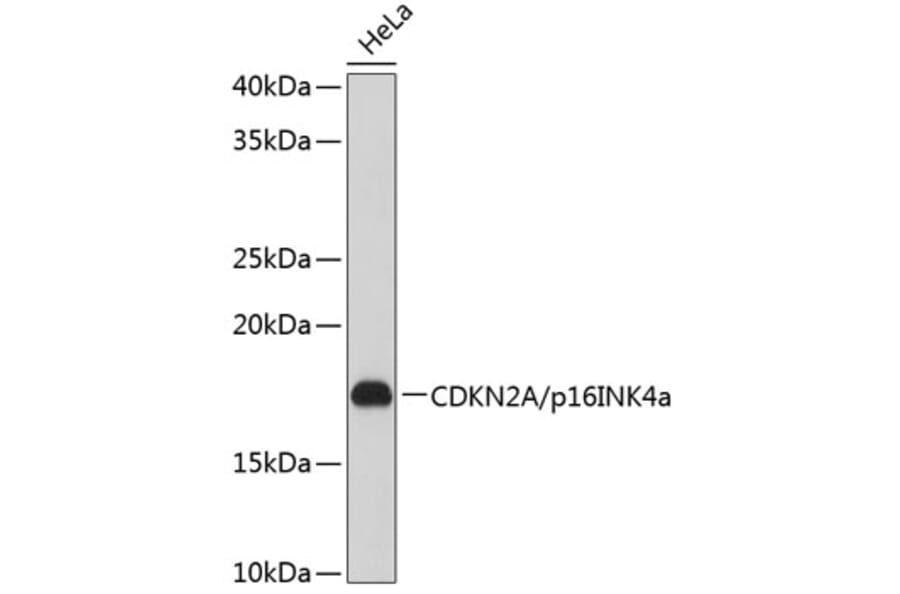 Western Blot - Anti-CDKN2A/p16INK4aF Antibody (A80851) - Antibodies.com