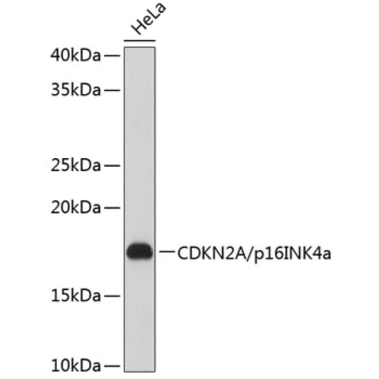 Western Blot - Anti-CDKN2A/p16INK4aF Antibody (A80851) - Antibodies.com