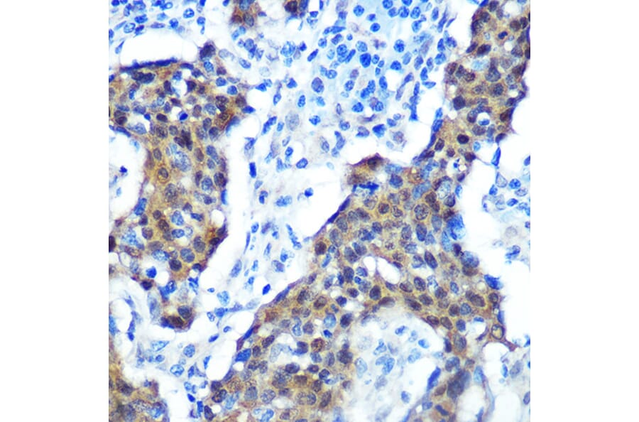 Immunohistochemistry - Anti-CDKN2A/p16INK4aF Antibody (A80851) - Antibodies.com
