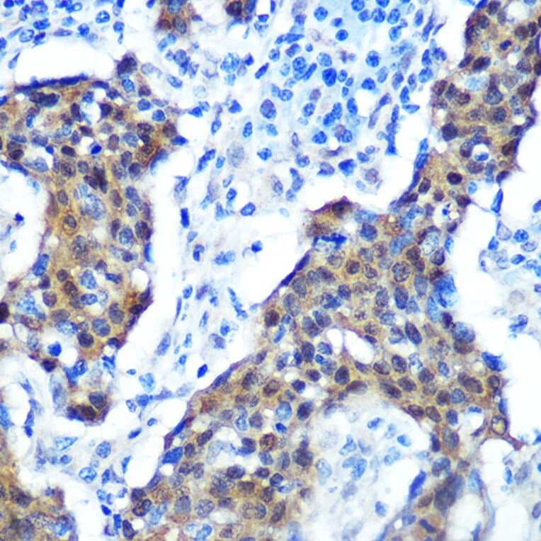 Immunohistochemistry - Anti-CDKN2A/p16INK4aF Antibody (A80851) - Antibodies.com