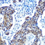 Immunohistochemistry - Anti-CDKN2A/p16INK4aF Antibody (A80851) - Antibodies.com