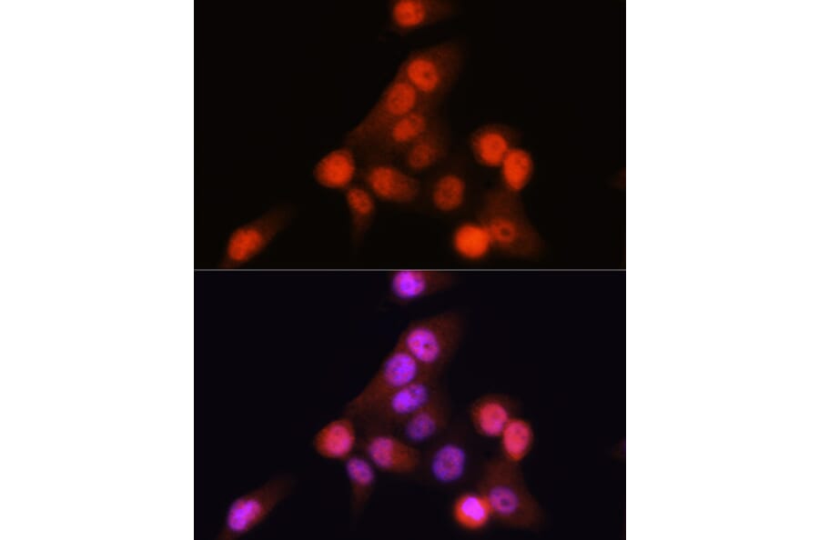 Immunofluorescence - Anti-CDKN2A/p16INK4aF Antibody (A80851) - Antibodies.com