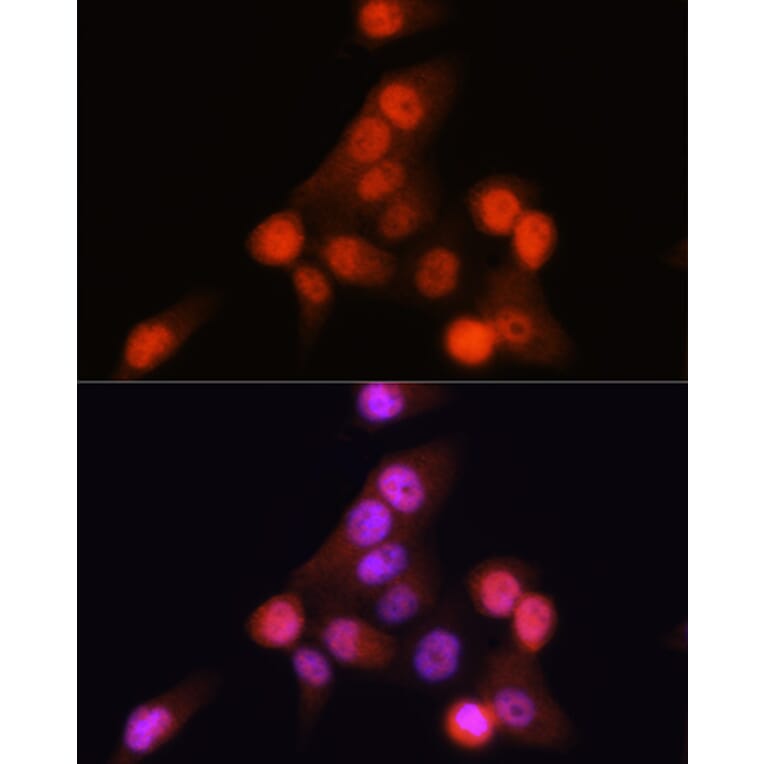 Immunofluorescence - Anti-CDKN2A/p16INK4aF Antibody (A80851) - Antibodies.com