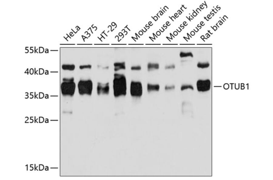 Western Blot - Anti-OTUB1 Antibody (A80852) - Antibodies.com