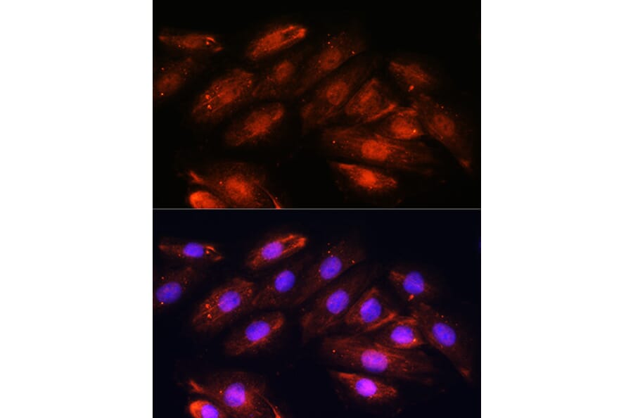 Immunofluorescence - Anti-OTUB1 Antibody (A80852) - Antibodies.com