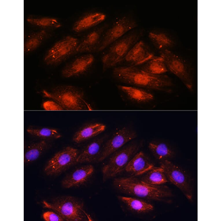 Immunofluorescence - Anti-OTUB1 Antibody (A80852) - Antibodies.com