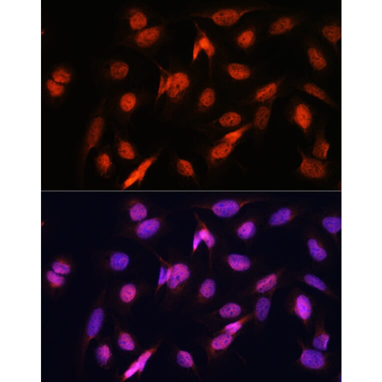 Immunofluorescence - Anti-OTUB1 Antibody (A80852) - Antibodies.com