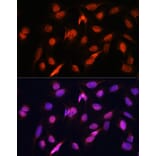 Immunofluorescence - Anti-OTUB1 Antibody (A80852) - Antibodies.com
