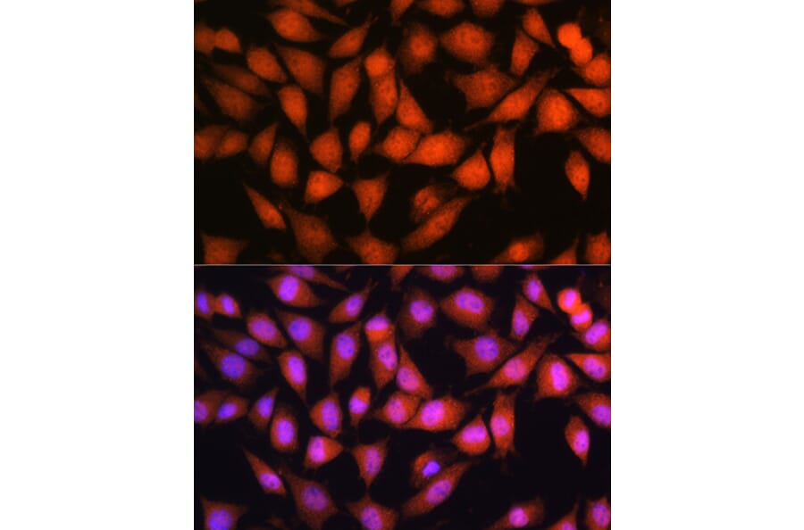Immunofluorescence - Anti-OTUB1 Antibody (A80852) - Antibodies.com