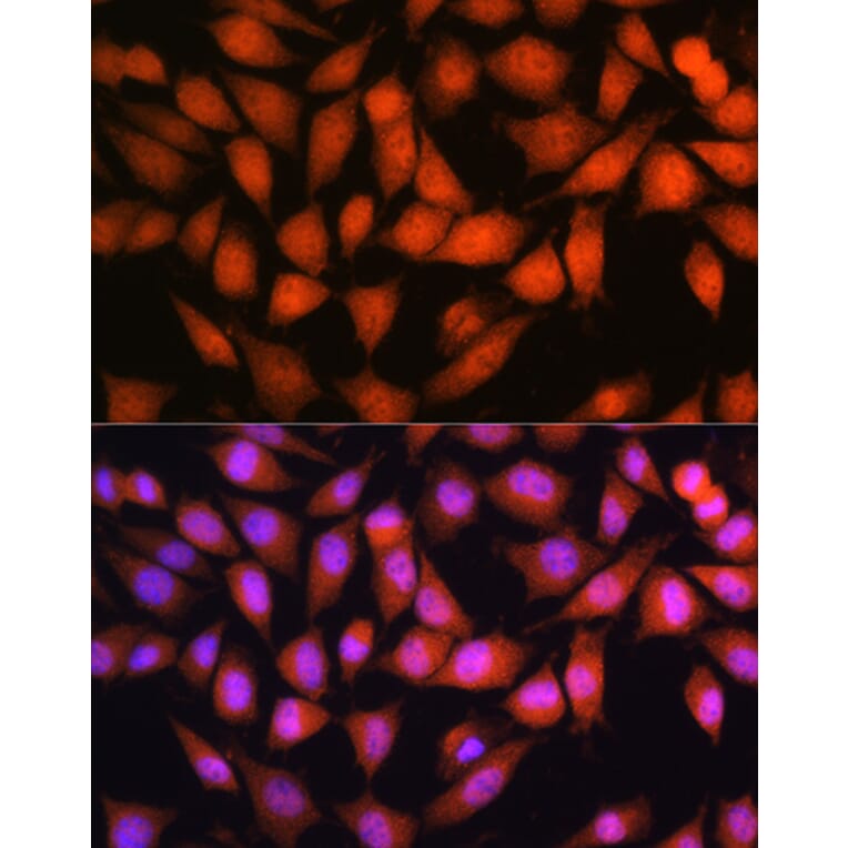 Immunofluorescence - Anti-OTUB1 Antibody (A80852) - Antibodies.com