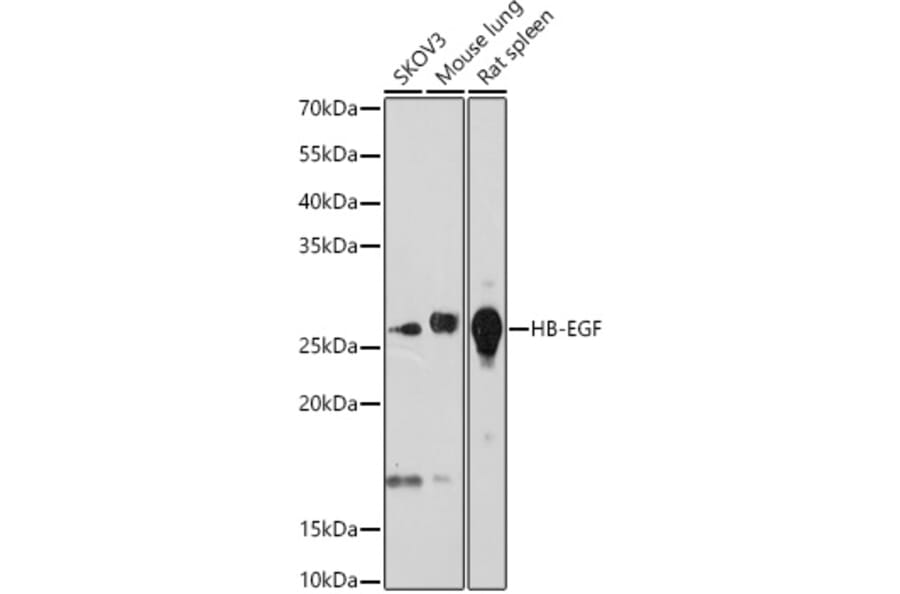 Western Blot - Anti-HBEGF/DTR Antibody [ARC0663] (A80853) - Antibodies.com