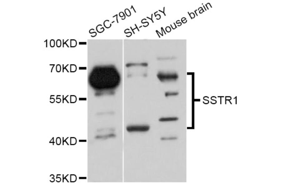 Western Blot - Anti-SSTR1 Antibody (A11659) - Antibodies.com