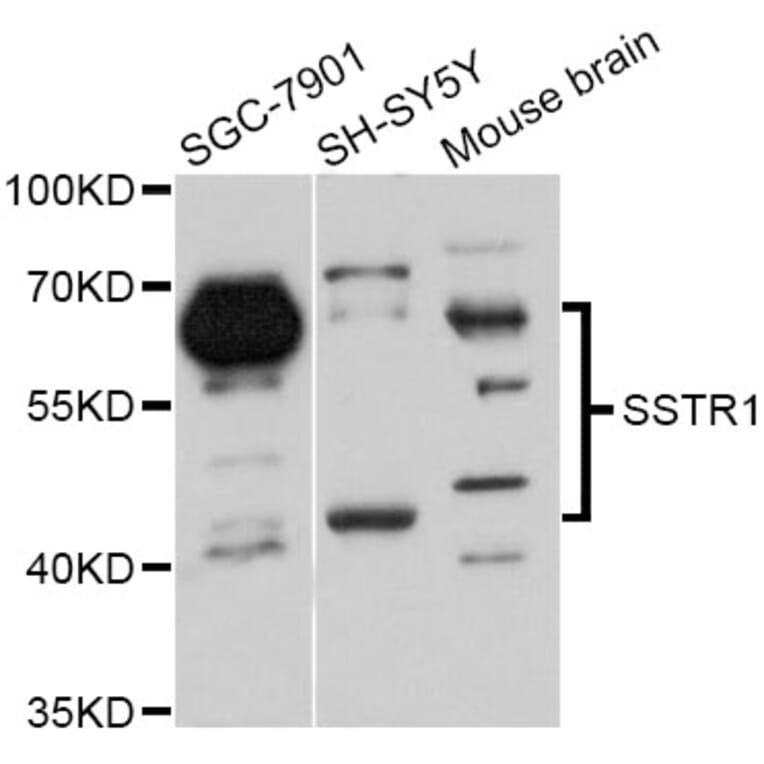 Western Blot - Anti-SSTR1 Antibody (A11659) - Antibodies.com