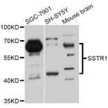 Western Blot - Anti-SSTR1 Antibody (A11659) - Antibodies.com
