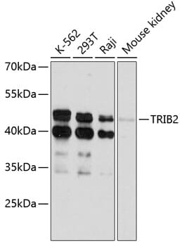 Western blot analysis of extracts of various cell lines, using Anti-TRIB2 Antibody (A11661) at 1:3000 dilution.
Secondary antibody: Goat Anti-Rabbit IgG (H+L) (HRP) (AS014) at 1:10,000 dilution.
Lysates / proteins: 25µg per lane.
Blocking buffer: 3% non-fat dry milk in TBST.
Detection: ECL Basic Kit (RM00020).
Exposure time: 90s.
