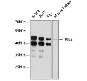 Western Blot - Anti-TRIB2 Antibody (A80855) - Antibodies.com
