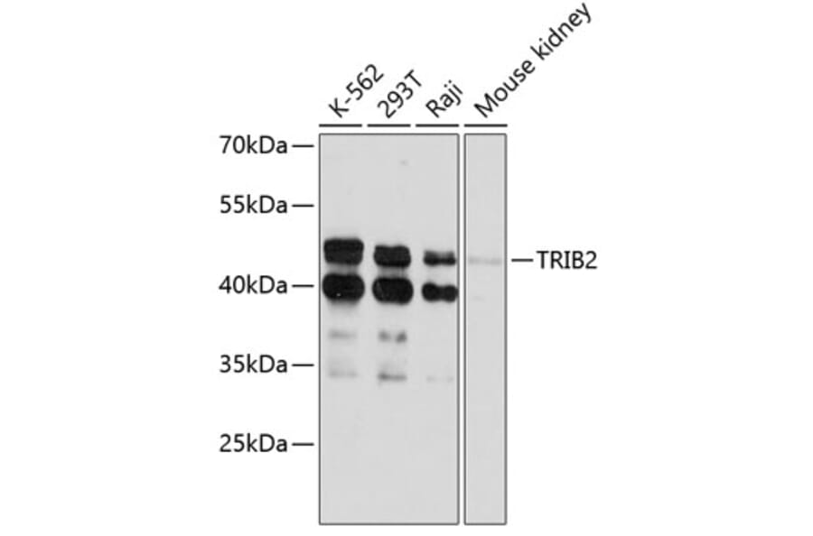 Western Blot - Anti-TRIB2 Antibody (A80855) - Antibodies.com