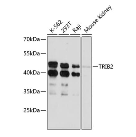 Western Blot - Anti-TRIB2 Antibody (A80855) - Antibodies.com