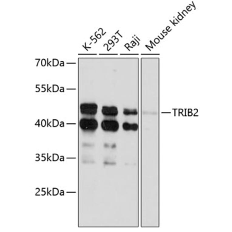 Western Blot - Anti-TRIB2 Antibody (A80855) - Antibodies.com