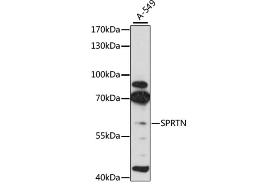 Western Blot - Anti-Spartan Antibody (A80856) - Antibodies.com