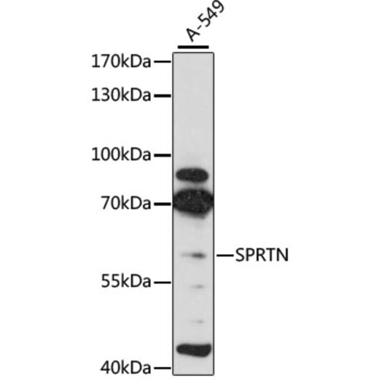 Western Blot - Anti-Spartan Antibody (A80856) - Antibodies.com