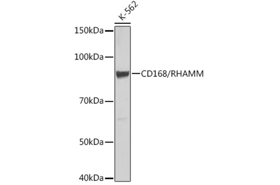 Western Blot - Anti-CD168 Antibody [ARC0667] (A80858) - Antibodies.com