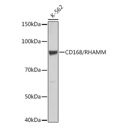 Western Blot - Anti-CD168 Antibody [ARC0667] (A80858) - Antibodies.com