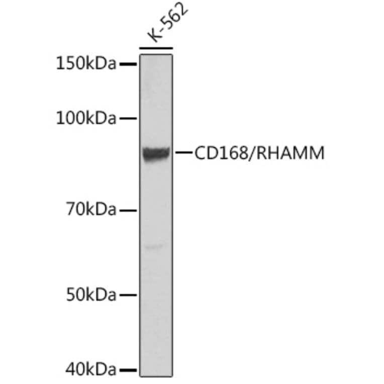 Western Blot - Anti-CD168 Antibody [ARC0667] (A80858) - Antibodies.com