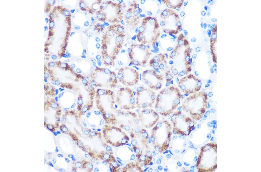 Immunohistochemistry - Anti-CD168 Antibody [ARC0667] (A80858) - Antibodies.com