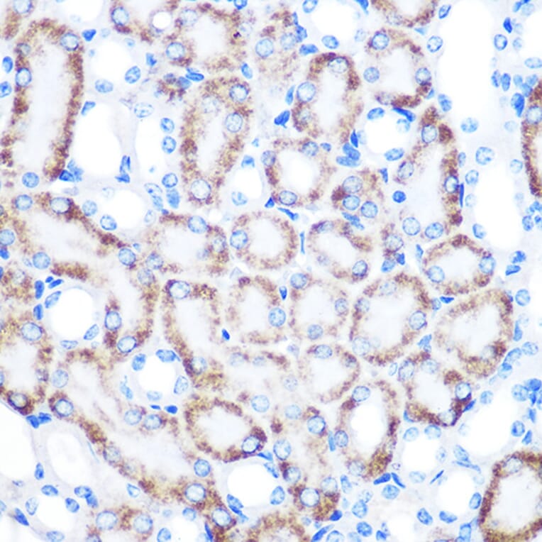 Immunohistochemistry - Anti-CD168 Antibody [ARC0667] (A80858) - Antibodies.com