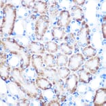 Immunohistochemistry - Anti-CD168 Antibody [ARC0667] (A80858) - Antibodies.com