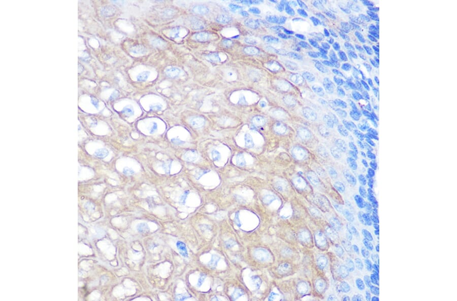Immunohistochemistry - Anti-CD168 Antibody [ARC0667] (A80858) - Antibodies.com