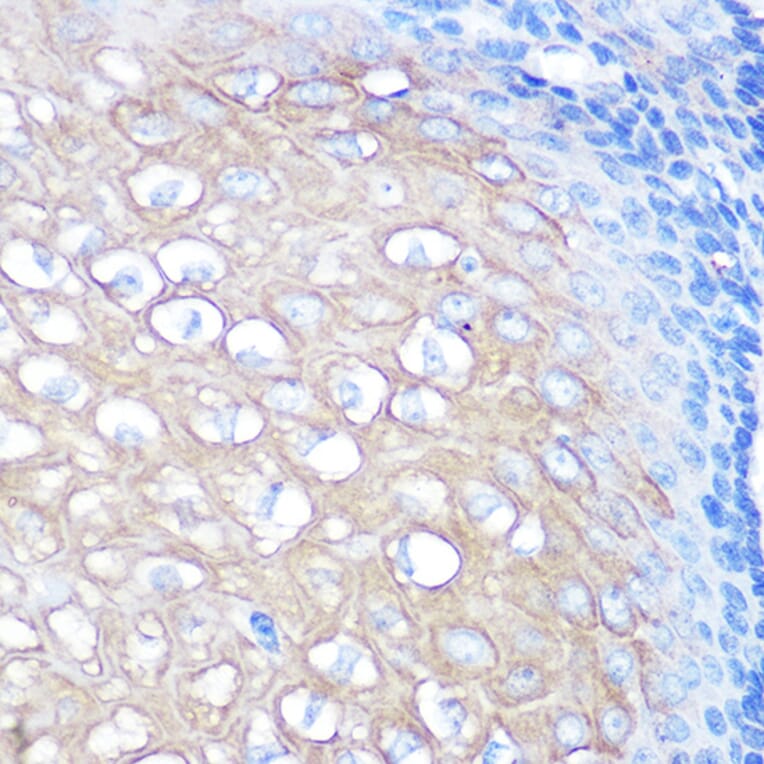 Immunohistochemistry - Anti-CD168 Antibody [ARC0667] (A80858) - Antibodies.com